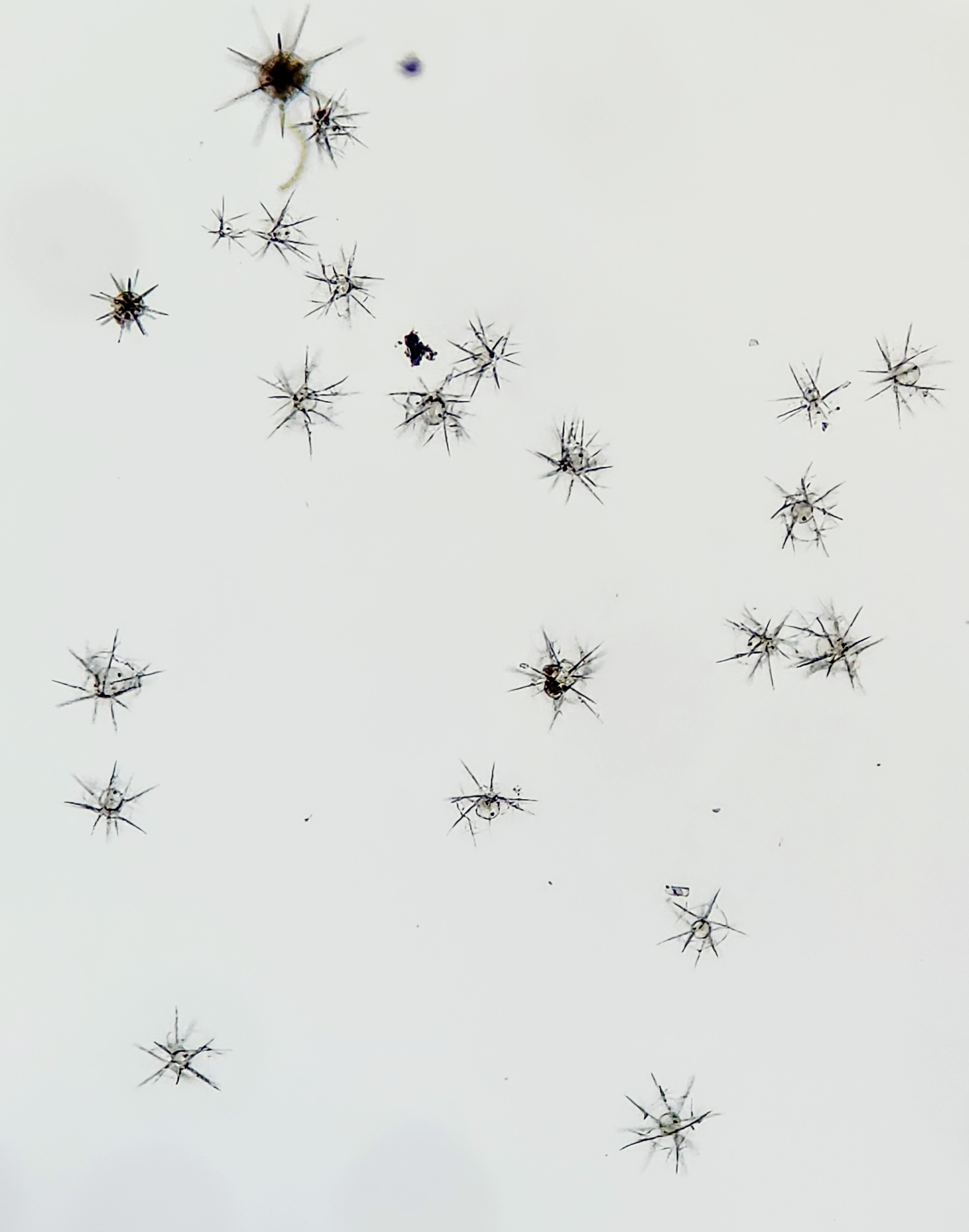 Isolated Plagiacantha cells under the microscope