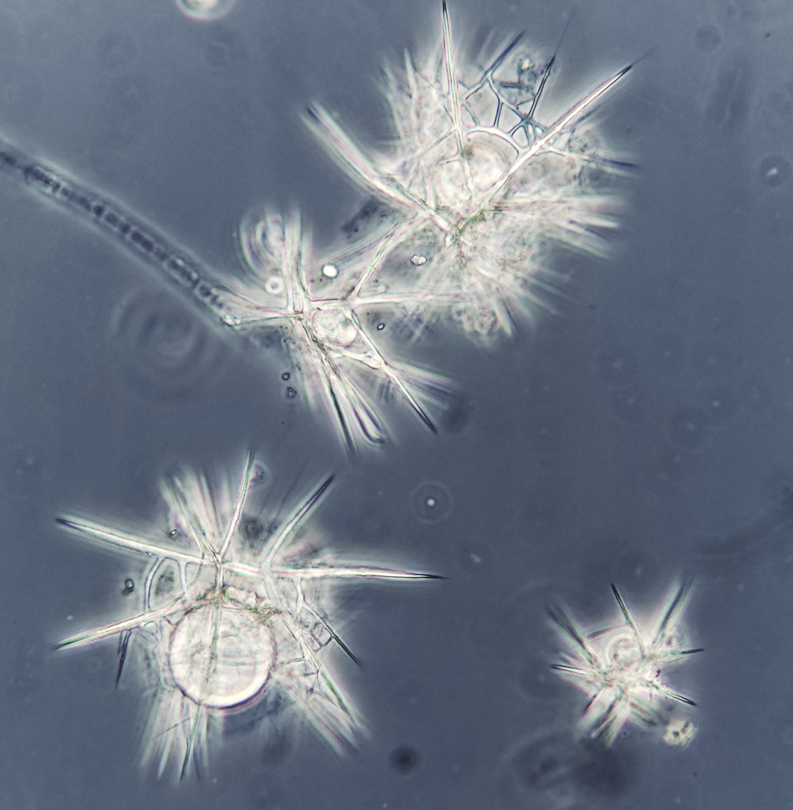 Four rariolarians at different life stages
