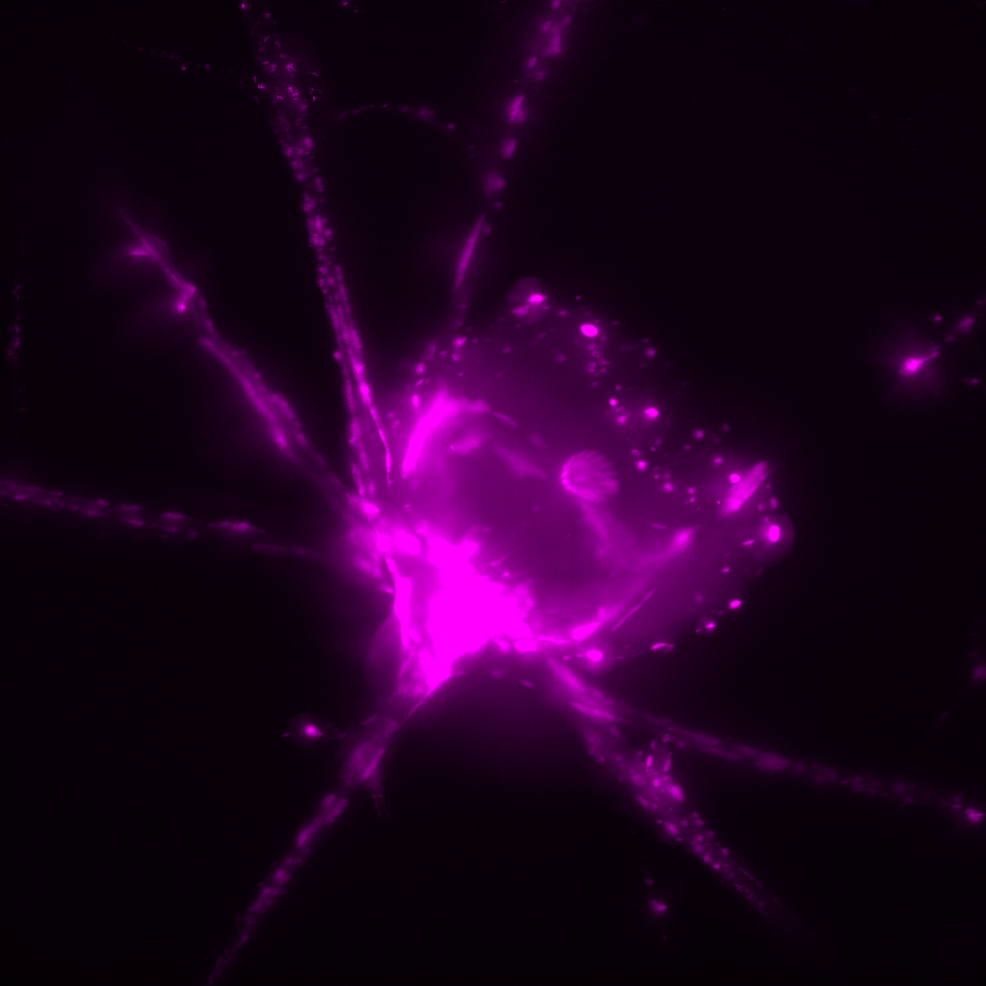 Expansion microscopy image of a Plagiacantha cell with microtubules labelled